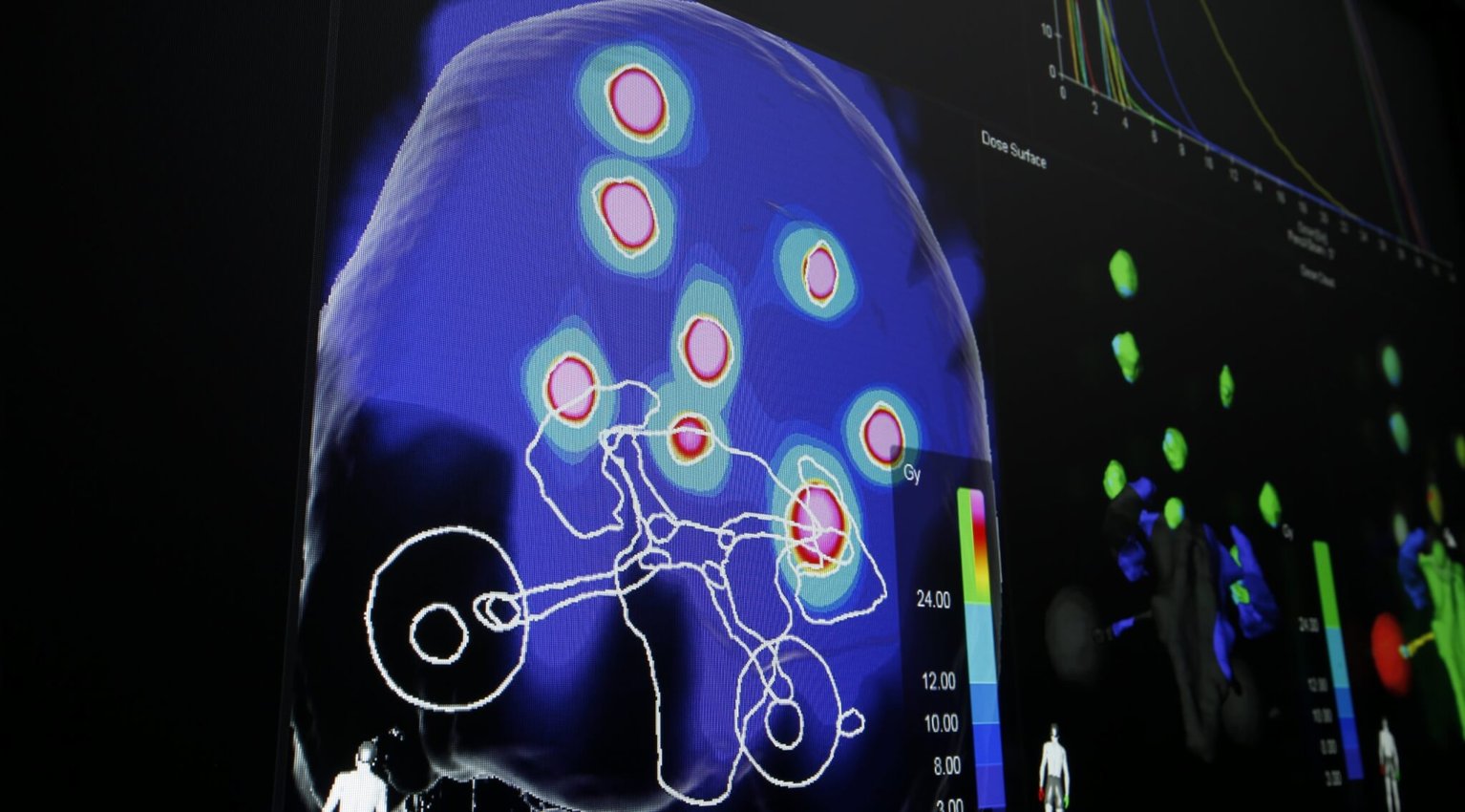 The Basics, Details &amp; Future of Stereotactic Treatments - Insights from a Medical Physicist