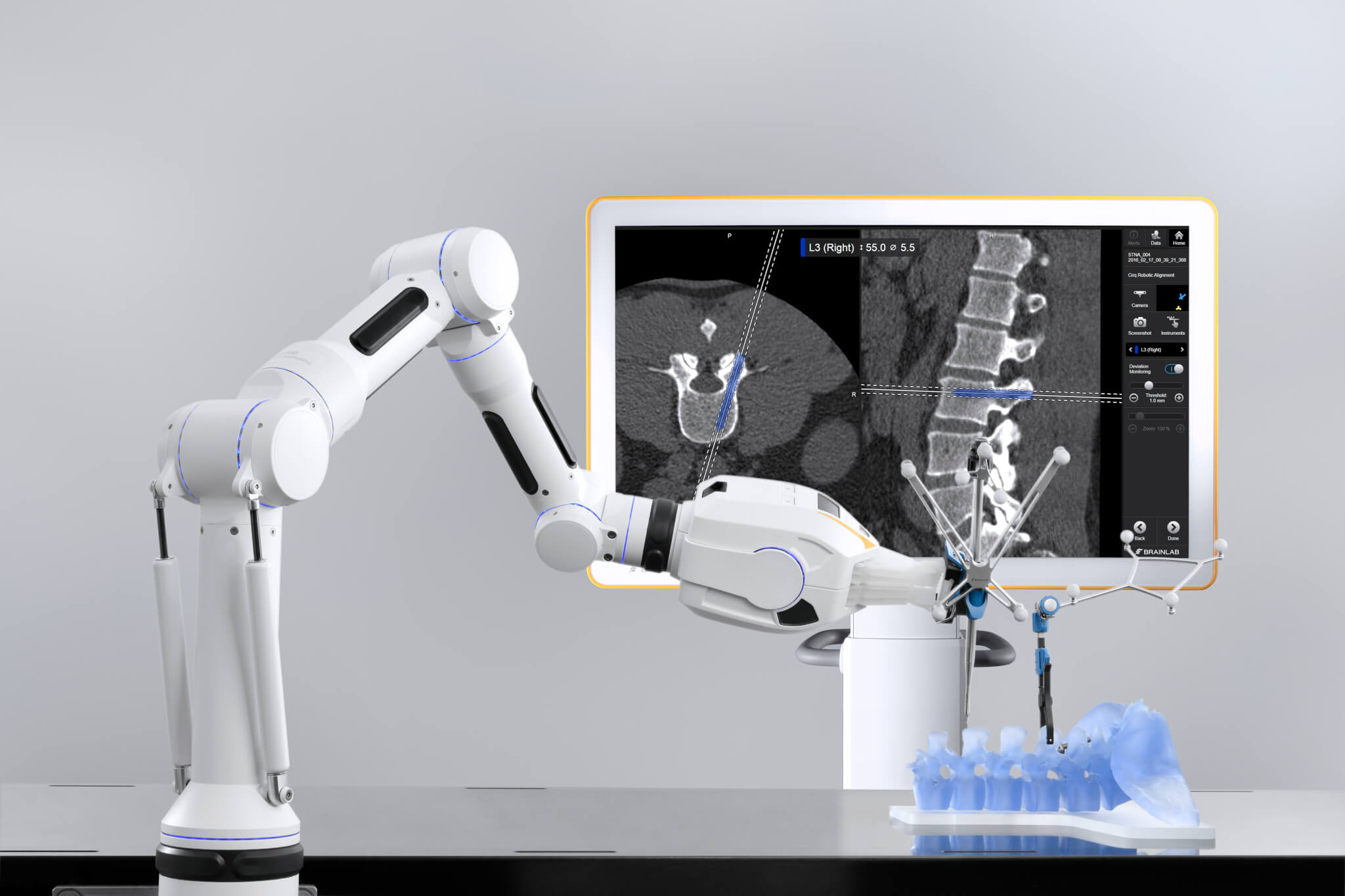 robotic-alingment-spine-surgery.jpg