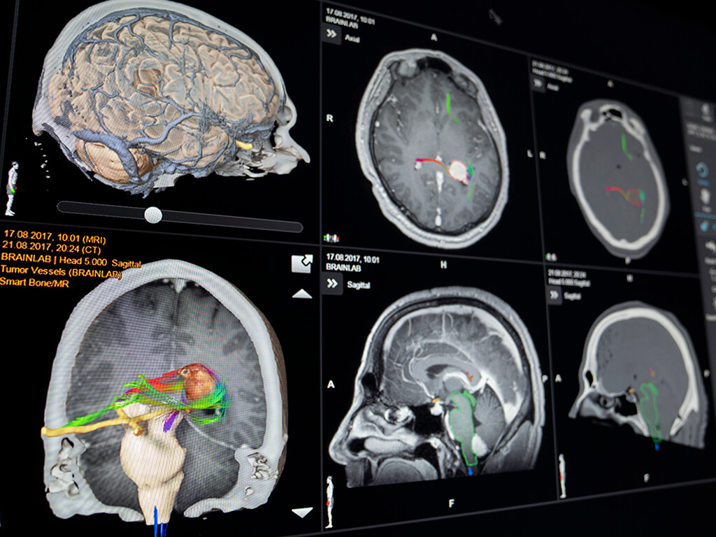 smart-anatomy-view_cranial-journal.jpg