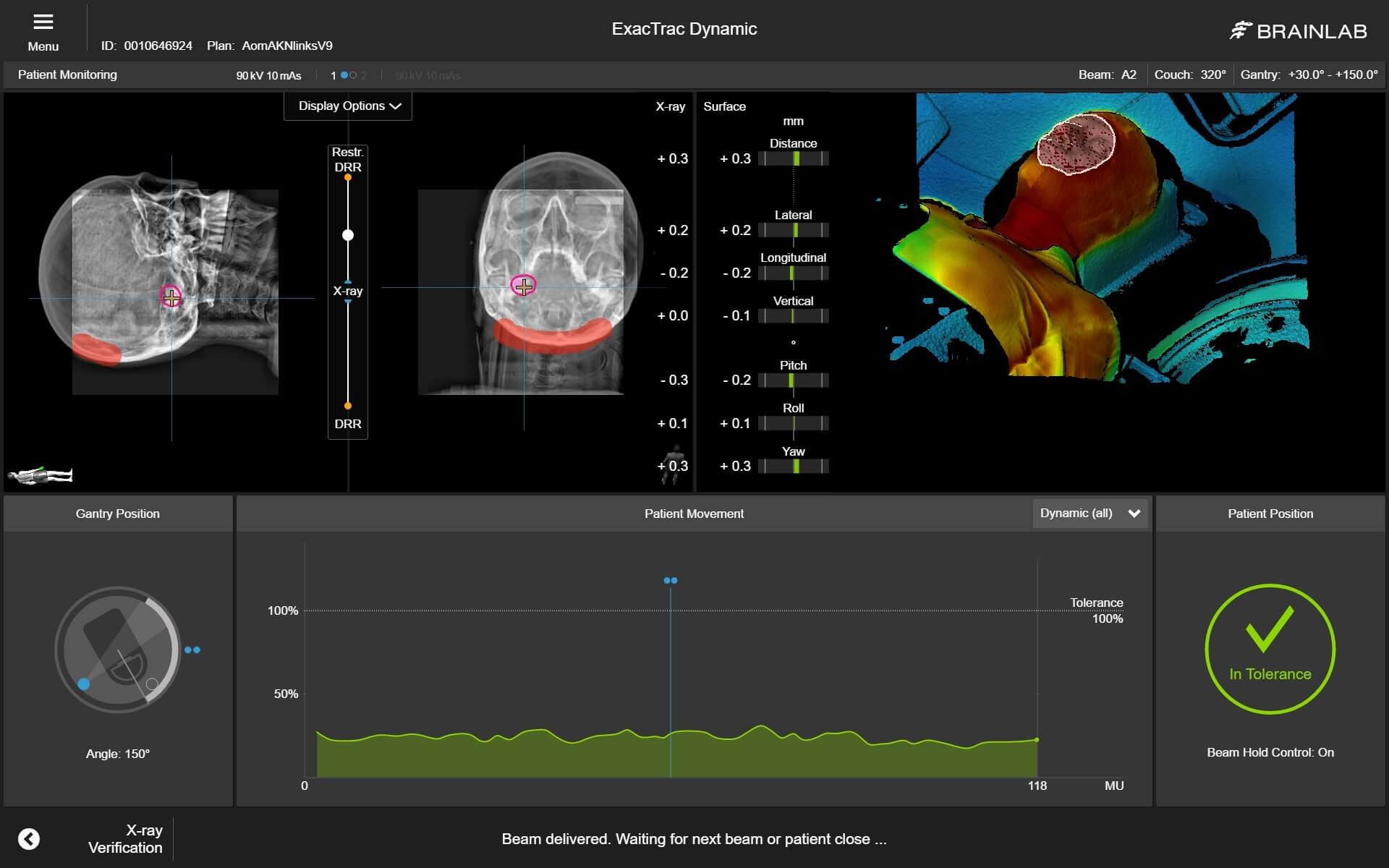 exactrac-dynamic-patient-monitoring.jpg