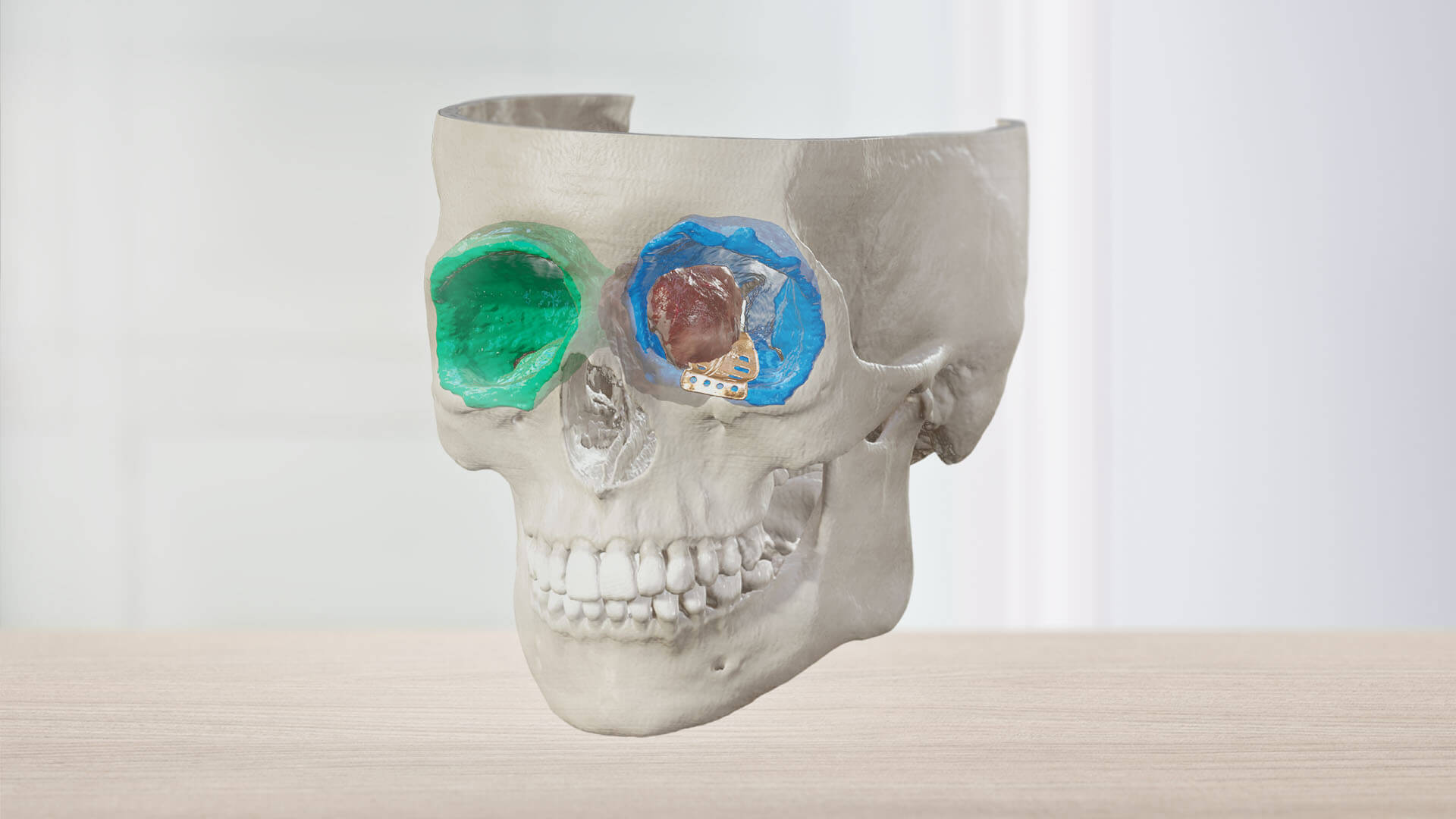 Detailed 3D view of a skull anatomy as seen through the Mixed Reality Viewer