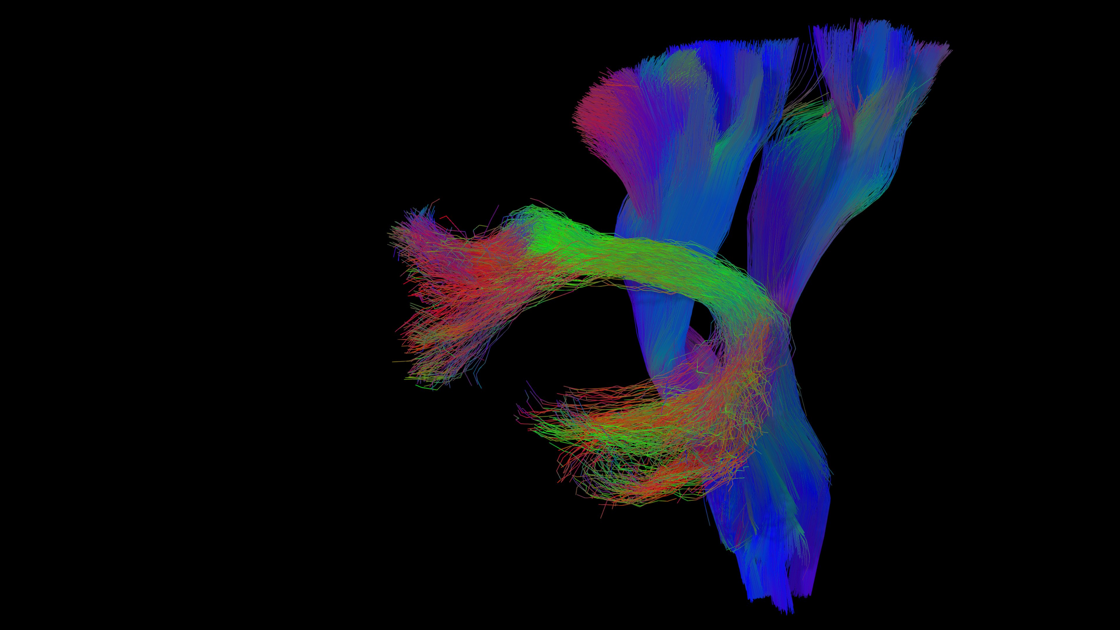 Fibertracking visualization highlighting ease of use with customizable templates