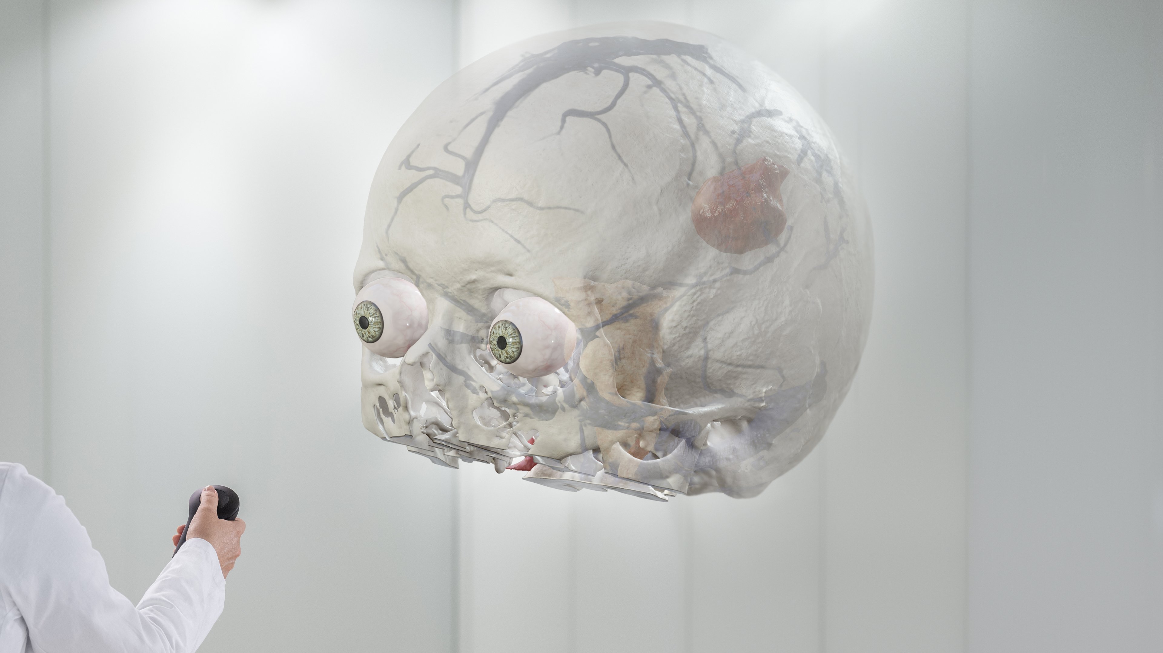 Mixed Reality Viewer in action, displaying cranial image