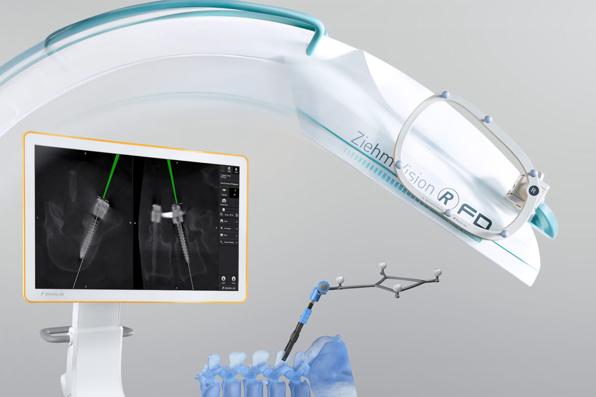 Photo illustrating how Brainlab Spine & Trauma Navigation seamlessly integrates with third-party instruments