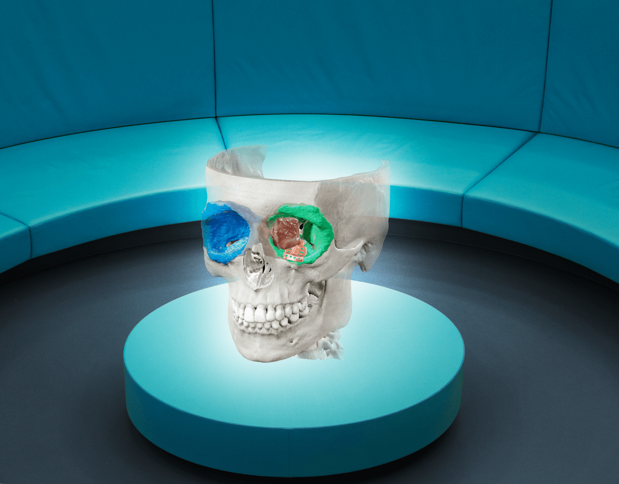 Cranial image viewed through Mixed Reality Viewer Glasses on a table in the center of the room