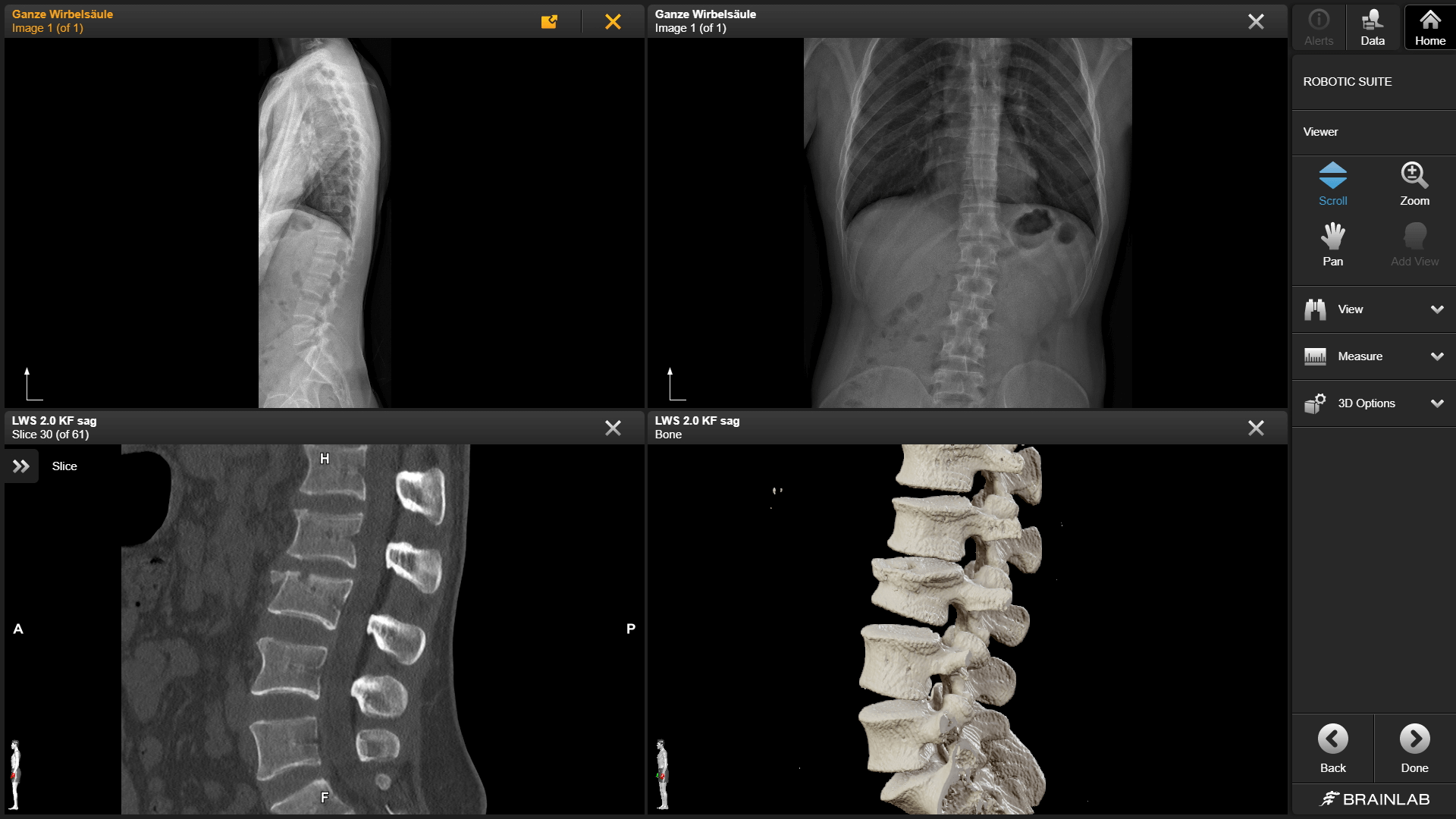 Screenshot: Interaction with DICOM images in the Elements Viewer application