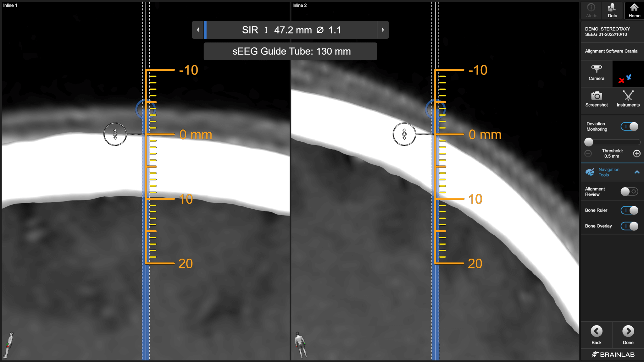 Cirq Alignment Software Cranial: Manual pre-alignment with anchor bolt height consideration