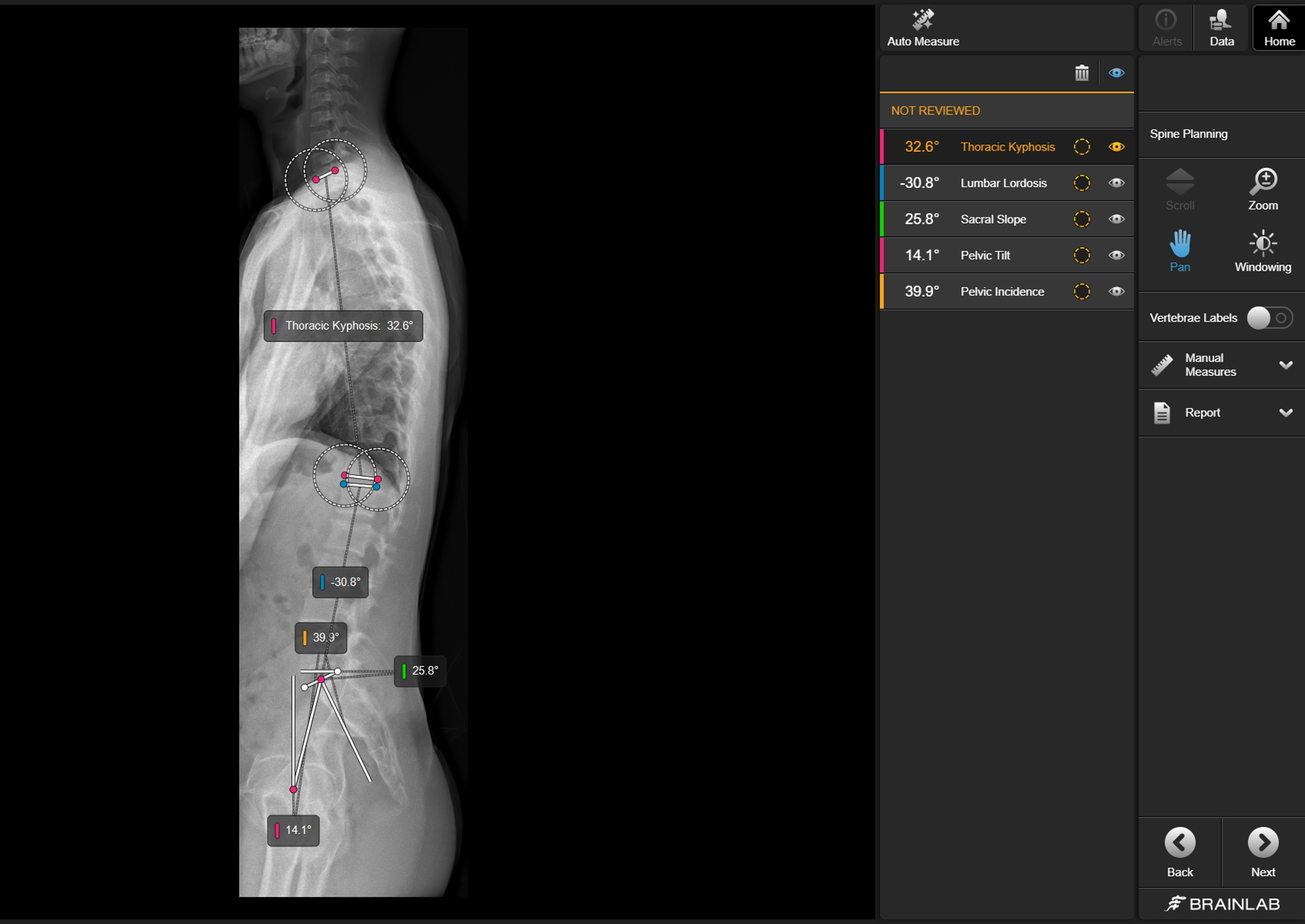 eurospine_spine-planning_measurement_website2023.png