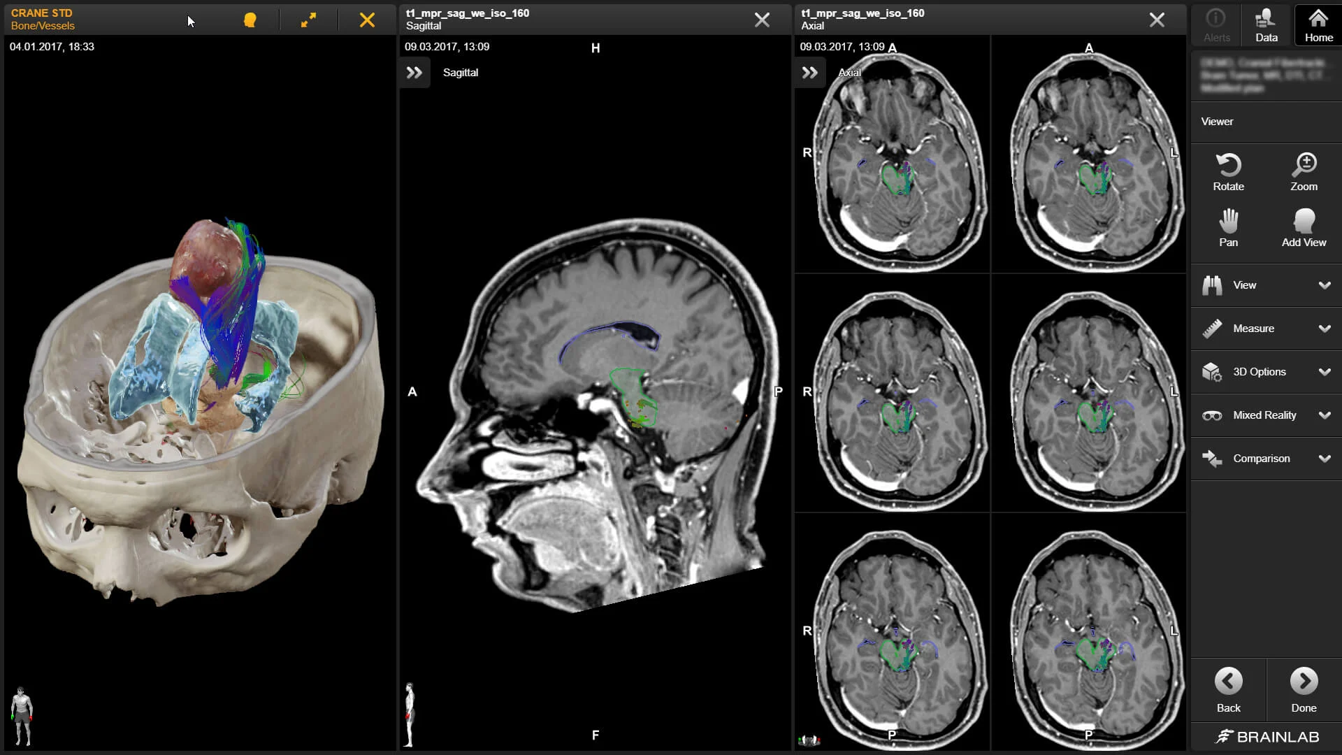 cranial-image.png