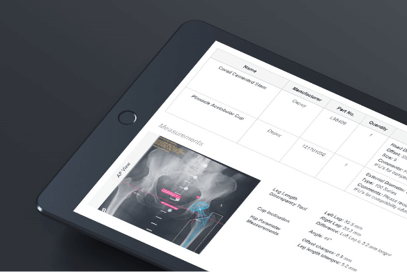 Screenshot: TraumaCad orthopedic templating software on tablet with comprehensive reports
