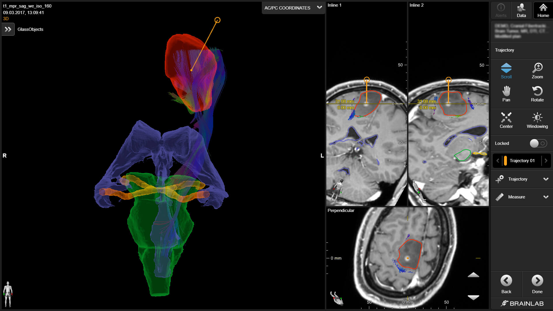 Screenshot of Elements Cranial Product Virtual iMRI