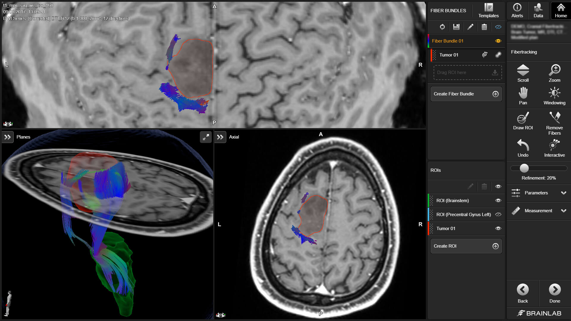 BOLD MRI Mapping